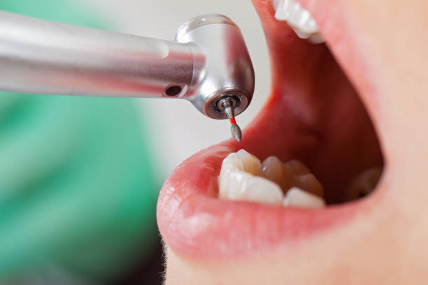 Best Chipped Tooth Repair Near Me  in Elizabeth, NJ